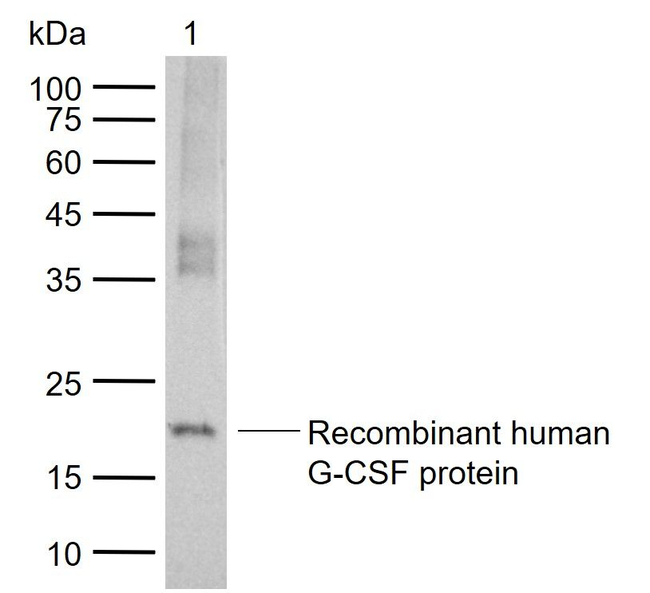 G-CSF Antibody in Western Blot (WB)