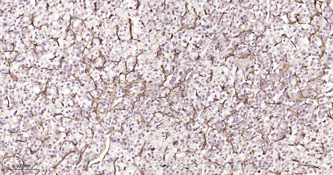 CD31 Antibody in Immunohistochemistry (Paraffin) (IHC (P))