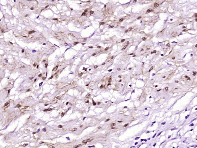 S100B Antibody in Immunohistochemistry (Paraffin) (IHC (P))
