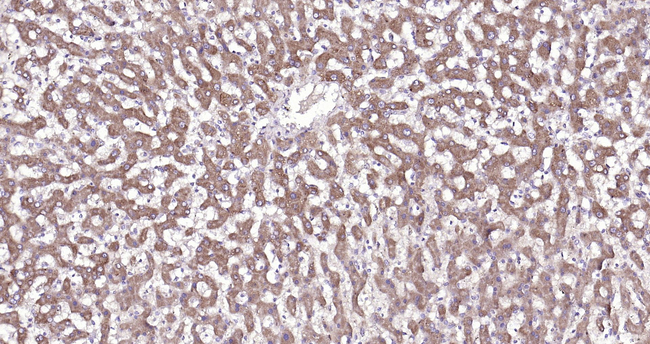 VEGF-165 Antibody in Immunohistochemistry (Paraffin) (IHC (P))