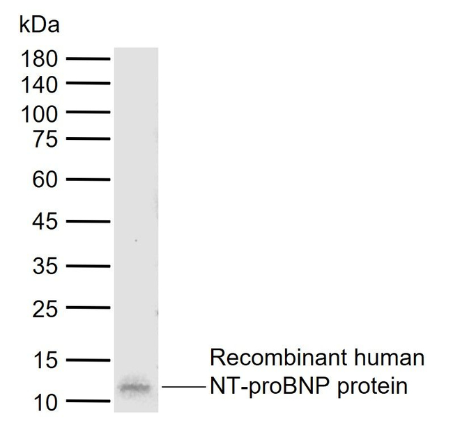 pro-Brain Natriuretic Peptide Antibody in Western Blot (WB)