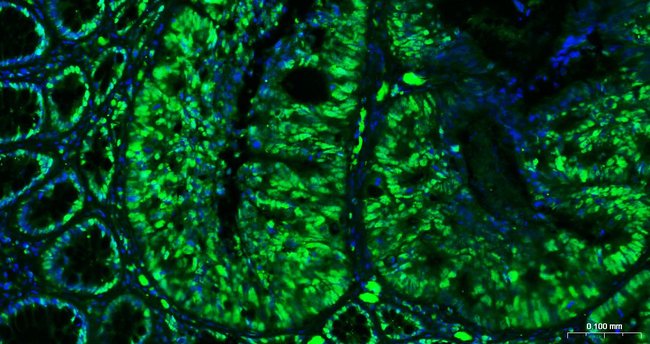 PCNA Antibody in Immunohistochemistry (Paraffin) (IHC (P))