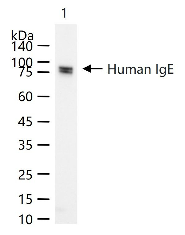 Human IgE Antibody in Western Blot (WB)