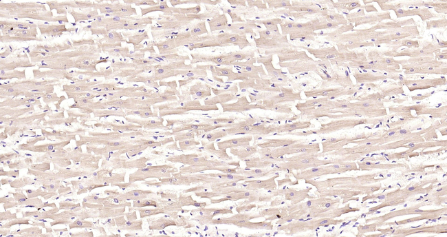 Cardiac Troponin I Antibody in Immunohistochemistry (Paraffin) (IHC (P))