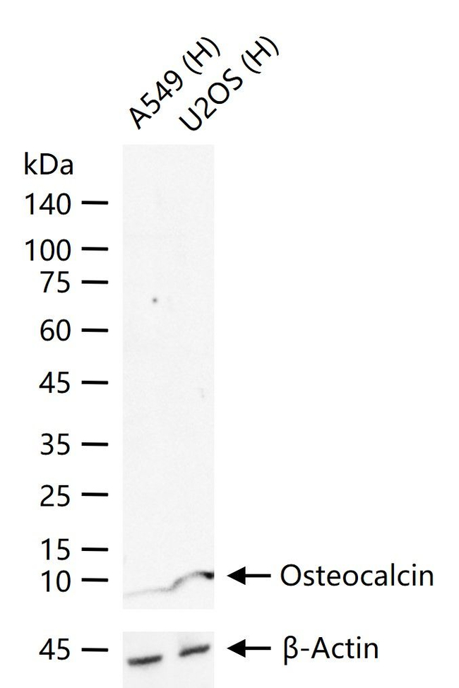 Osteocalcin Antibody in Western Blot (WB)