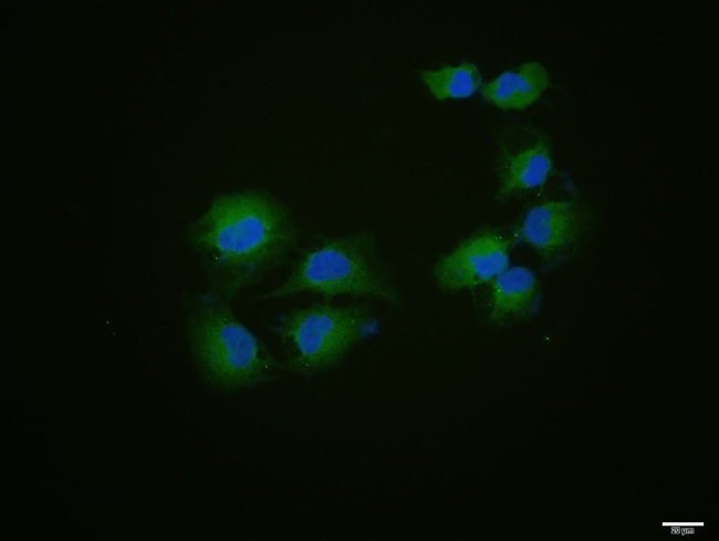 CD34 Antibody in Immunocytochemistry (ICC/IF)