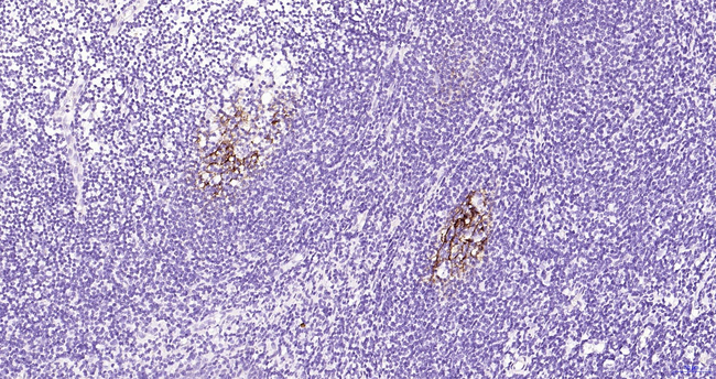 CD23 Antibody in Immunohistochemistry (Paraffin) (IHC (P))