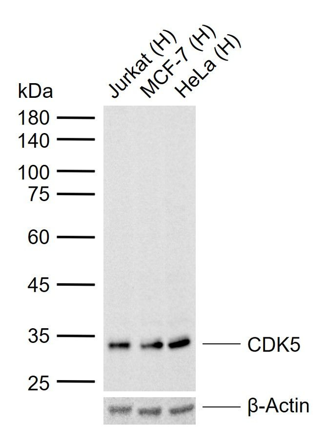 CDK5 Antibody in Western Blot (WB)