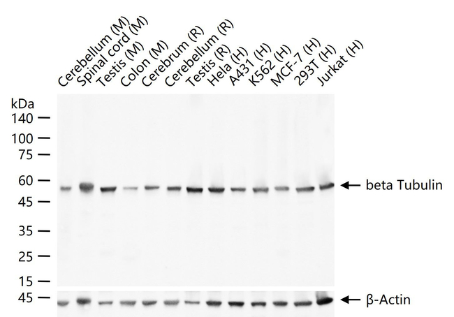 beta Tubulin Antibody in Western Blot (WB)