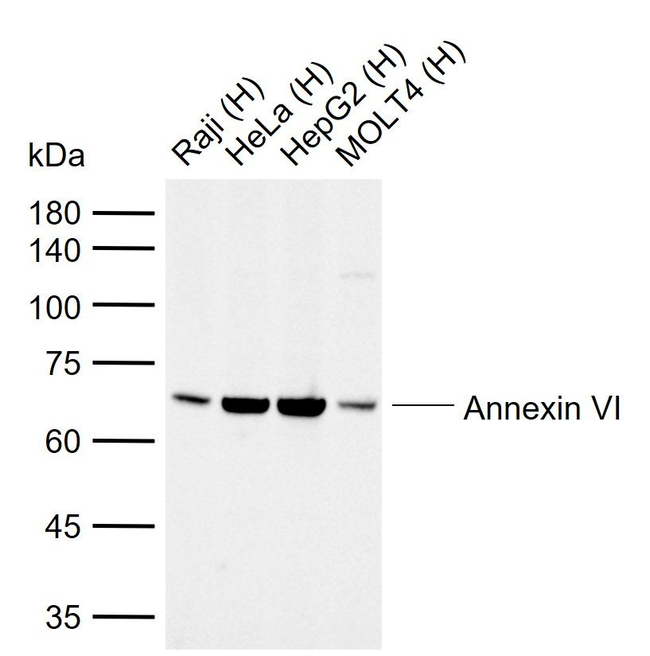 Annexin A6 Antibody in Western Blot (WB)