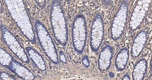 beta Actin Antibody in Immunohistochemistry (Paraffin) (IHC (P))