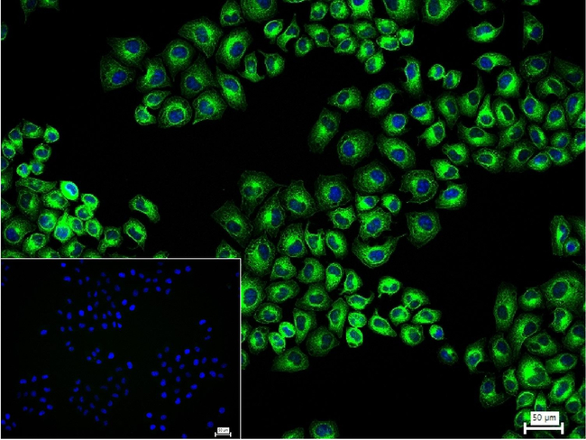 beta Tubulin Antibody in Immunocytochemistry (ICC/IF)