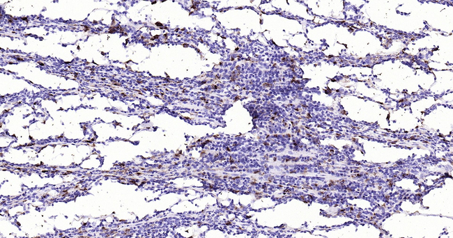 CD68 Antibody in Immunohistochemistry (Paraffin) (IHC (P))