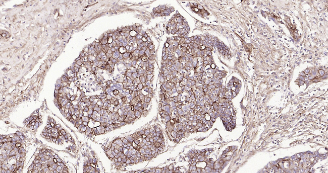 ABCB5 Antibody in Immunohistochemistry (Paraffin) (IHC (P))