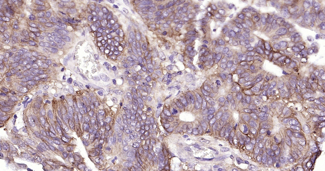 Carbonic Anhydrase IX Antibody in Immunohistochemistry (Paraffin) (IHC (P))