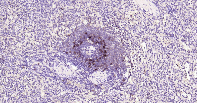 CD23 Antibody in Immunohistochemistry (Paraffin) (IHC (P))