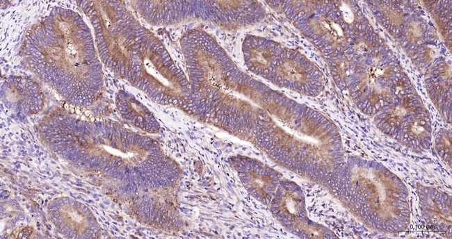 NFkB p65 Antibody in Immunohistochemistry (Paraffin) (IHC (P))