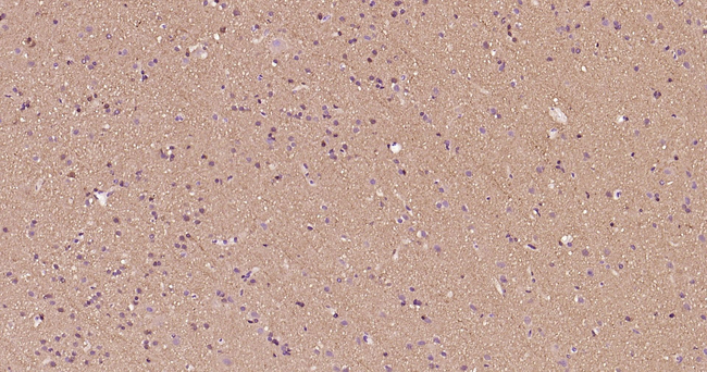 beta Tubulin Antibody in Immunohistochemistry (Paraffin) (IHC (P))