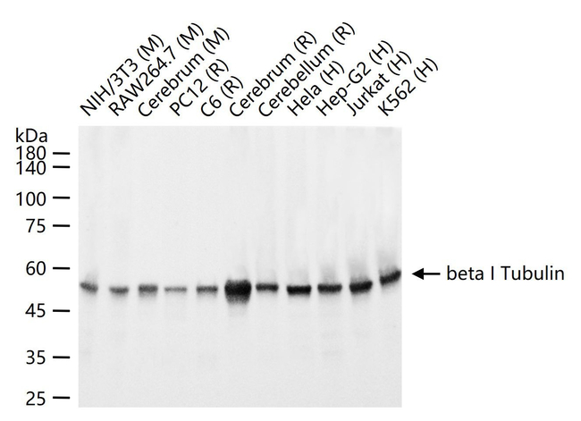 TUBB1 Antibody in Western Blot (WB)