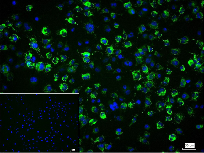 Collagen III Antibody in Immunocytochemistry (ICC/IF)
