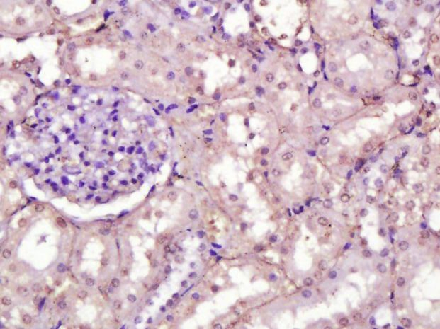 Fibronectin Antibody in Immunohistochemistry (Paraffin) (IHC (P))