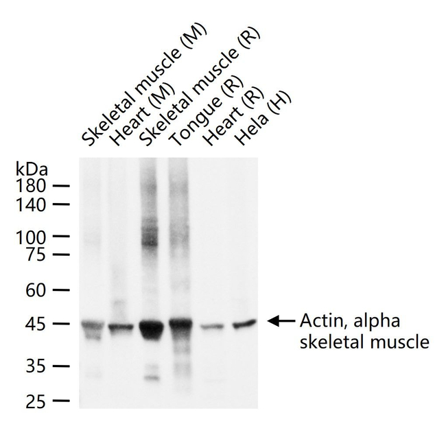 ACTA1 Antibody in Western Blot (WB)
