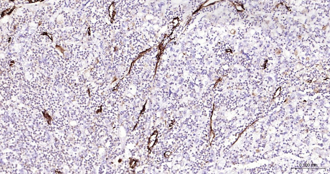 Vimentin Antibody in Immunohistochemistry (Paraffin) (IHC (P))