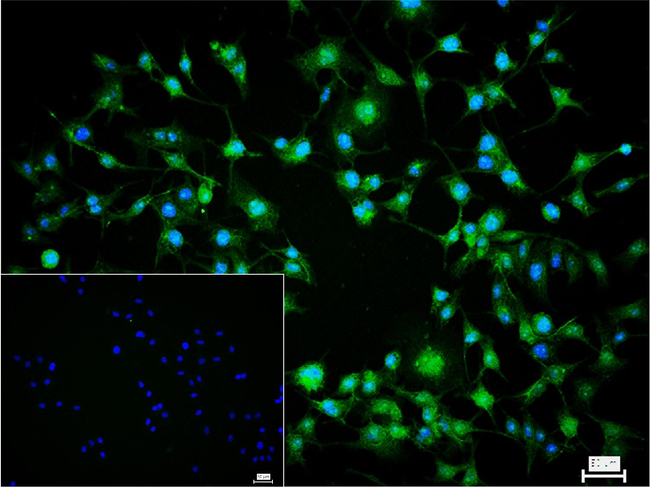 Pan-Methyl Lysine Antibody in Immunocytochemistry (ICC/IF)