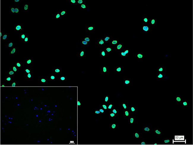 Acetylated Lysine Antibody in Immunocytochemistry (ICC/IF)