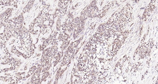 HSC70 Antibody in Immunohistochemistry (Paraffin) (IHC (P))