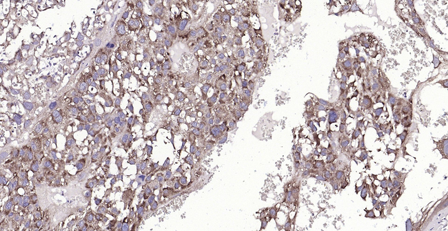 Cyclophilin B Antibody in Immunohistochemistry (Paraffin) (IHC (P))
