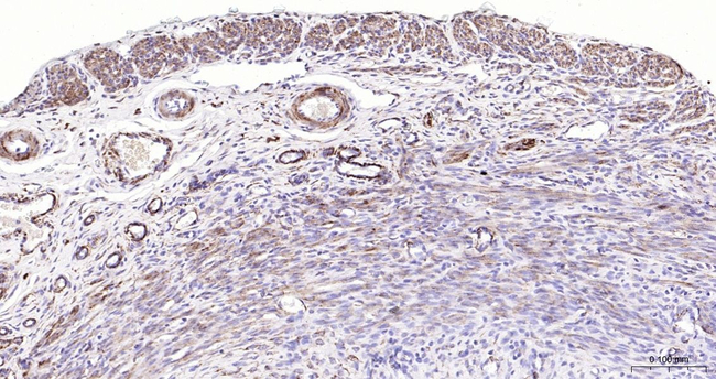 Desmin Antibody in Immunohistochemistry (Paraffin) (IHC (P))
