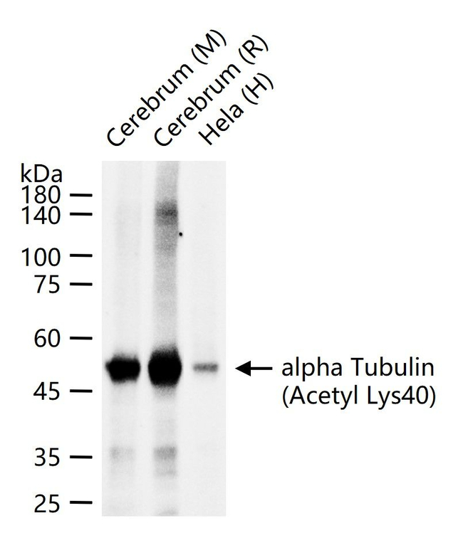 Acetyl-alpha Tubulin (Lys40) Antibody in Western Blot (WB)