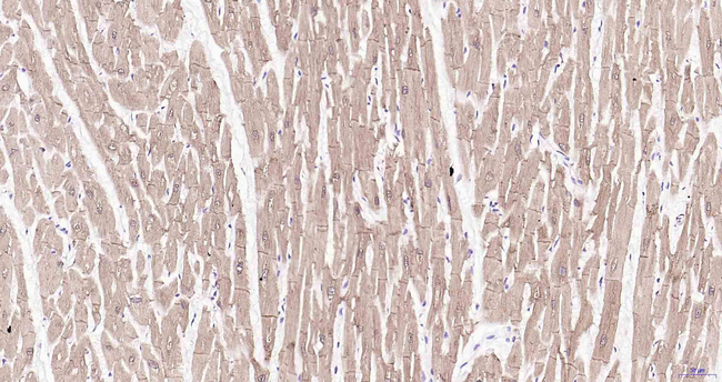 HSPB8 Antibody in Immunohistochemistry (Paraffin) (IHC (P))