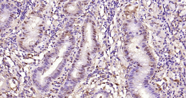 Galectin 3 Antibody in Immunohistochemistry (Paraffin) (IHC (P))