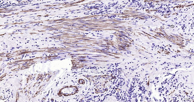 ACTA1 Antibody in Immunohistochemistry (Paraffin) (IHC (P))