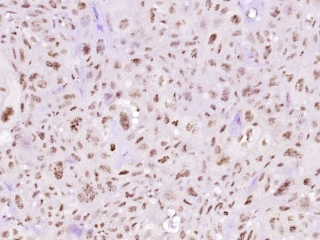 Phospho-STAT3 (Tyr705) Antibody in Immunohistochemistry (Paraffin) (IHC (P))