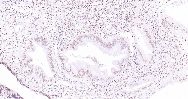 ERK1 Antibody in Immunohistochemistry (Paraffin) (IHC (P))