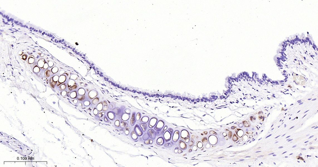 Collagen II Antibody in Immunohistochemistry (Paraffin) (IHC (P))