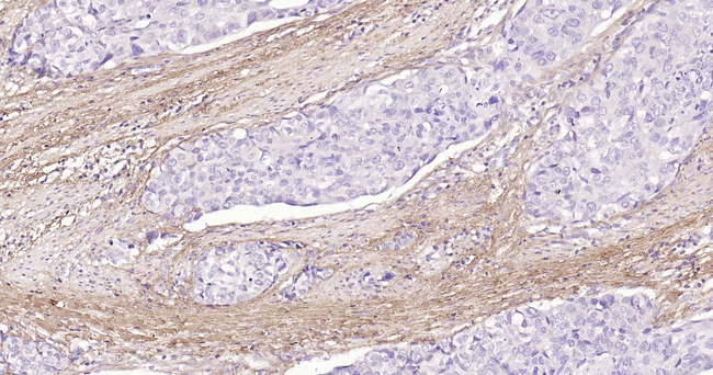 Collagen I Antibody in Immunohistochemistry (Paraffin) (IHC (P))