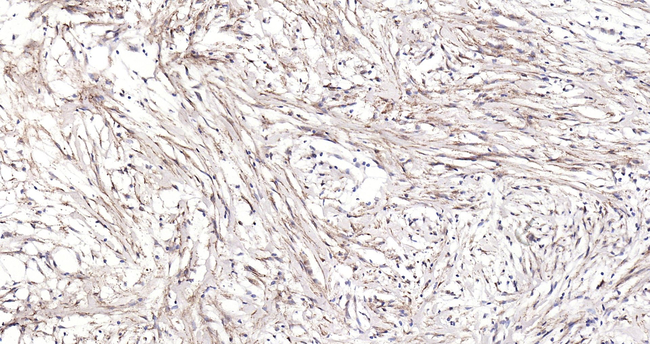 Collagen II Antibody in Immunohistochemistry (Paraffin) (IHC (P))