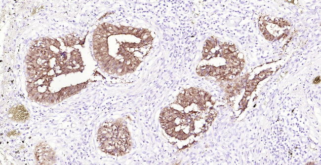 Villin Antibody in Immunohistochemistry (Paraffin) (IHC (P))