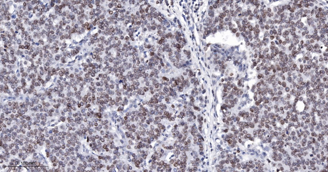 Lamin B1 Antibody in Immunohistochemistry (Paraffin) (IHC (P))