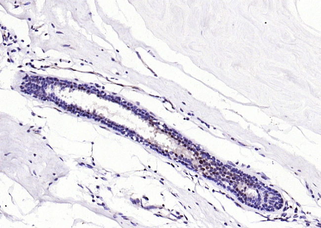 Calprotectin Antibody in Immunohistochemistry (Paraffin) (IHC (P))