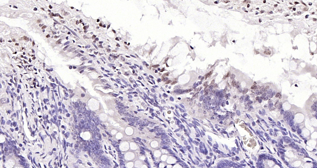 SOCS1 Antibody in Immunohistochemistry (Paraffin) (IHC (P))
