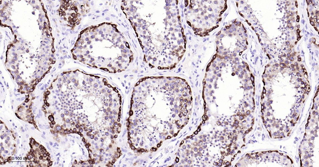 MAGEC1 Antibody in Immunohistochemistry (Paraffin) (IHC (P))