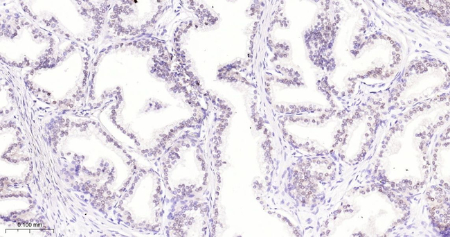 Nkx3.1 Antibody in Immunohistochemistry (Paraffin) (IHC (P))
