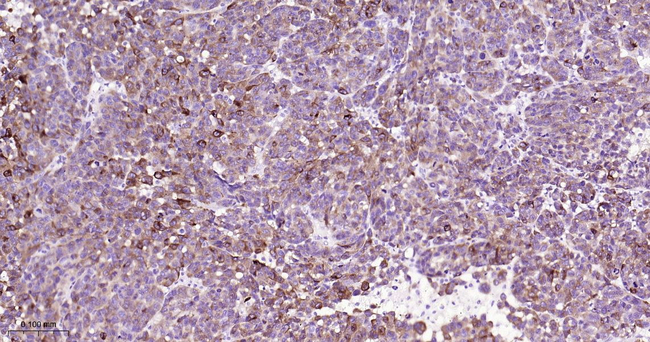 Melan-A Antibody in Immunohistochemistry (Paraffin) (IHC (P))