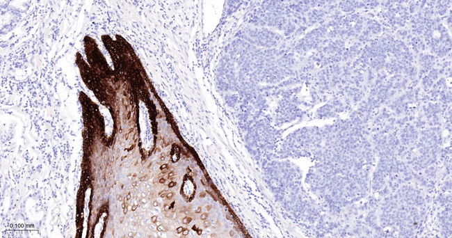 Cytokeratin 15 Antibody in Immunohistochemistry (Paraffin) (IHC (P))