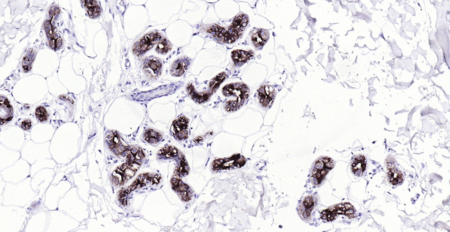 GCDFP-15 Antibody in Immunohistochemistry (Paraffin) (IHC (P))